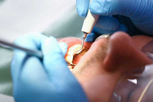 Best 24-Hour Emergency Dentist  in Campbell, MO